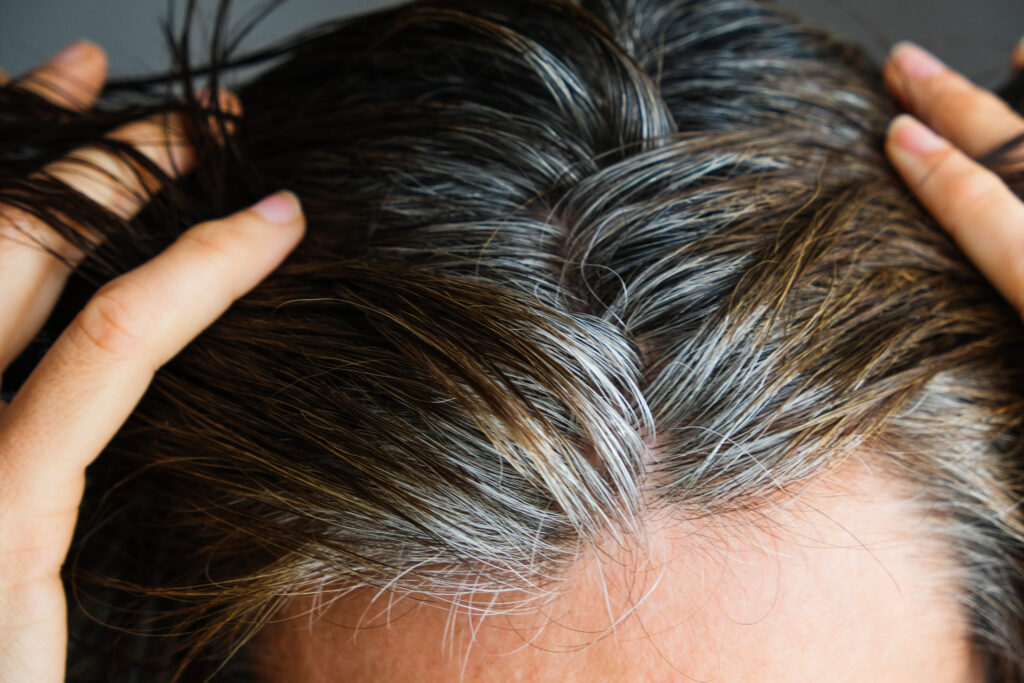 Going gray. Middle aged woman with dark brown hair and regrown gray hair roots.